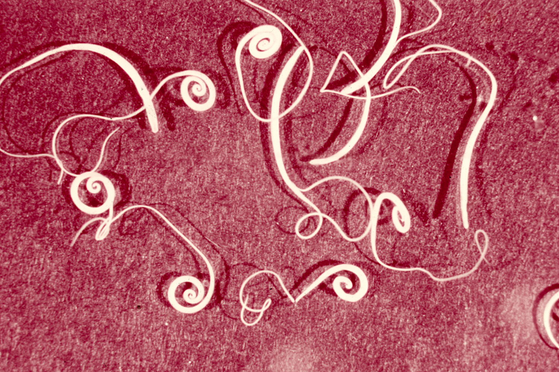 Illustration for article titled Can the United States Cope With a Resurgence of Tropical Disease?